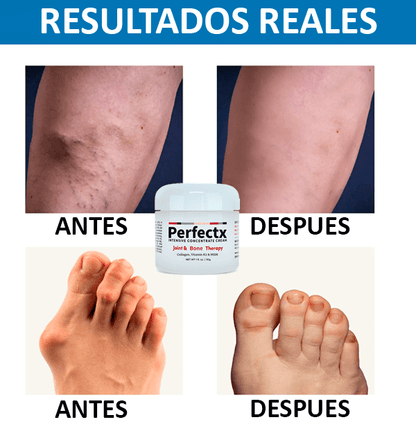 Perfectx™ Terapia Articular y Muscular: Lleva 2 al Precio de 1!